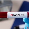 2025 Covid-19 Etkileri